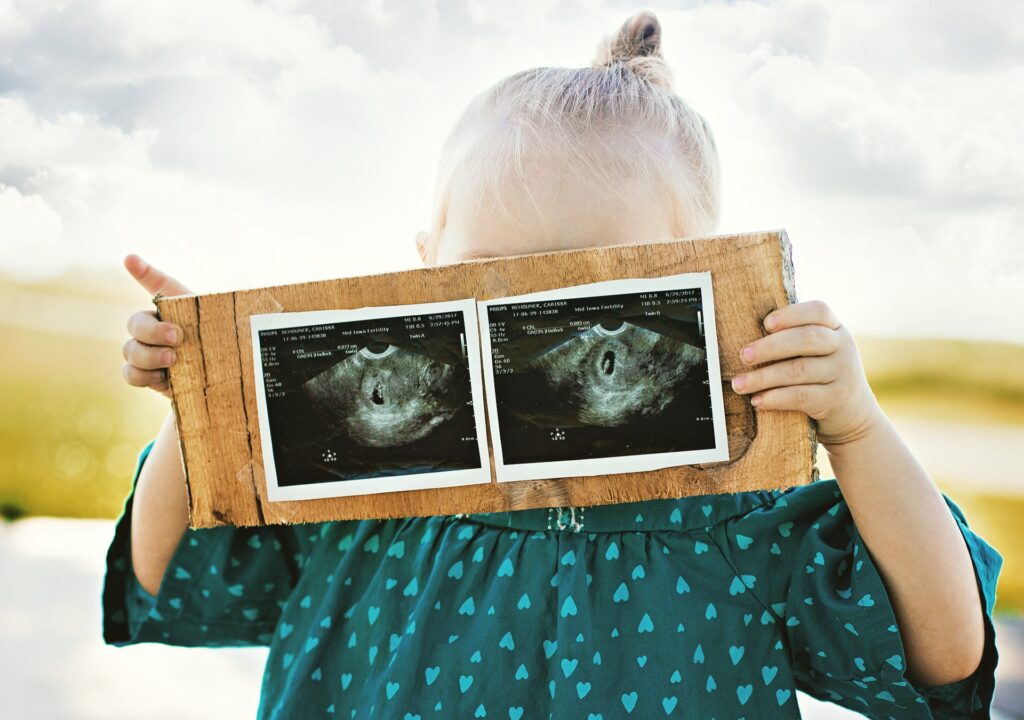 Little girl holding a sign with twin ultrasound pictures. Twin pregnancy announcement. Why I don't want to forget what it's like to struggle with infertility.